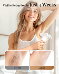 3-in-1 IPL Laser Hair Removal Device – Fast & Painless