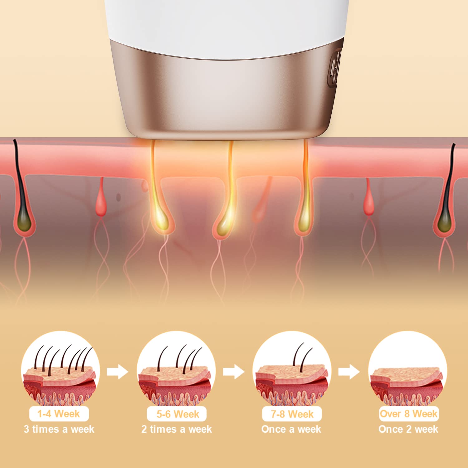 IPL Laser Hair Removal Device - 9 Energy Levels, 999,000 Flashes